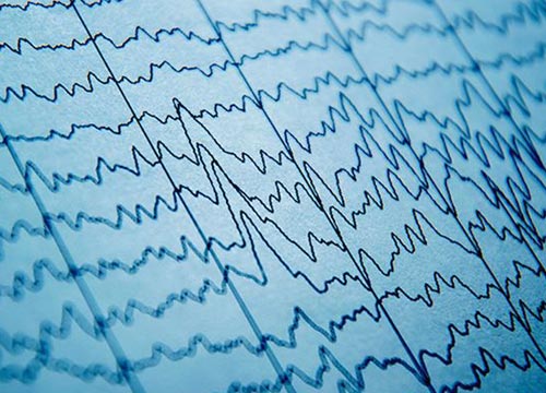 sanita_EEG sanita EEG